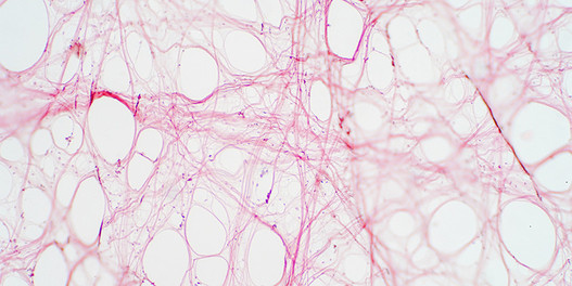Das «Spinnennetz» der Faszien unter dem Mikroskop.
