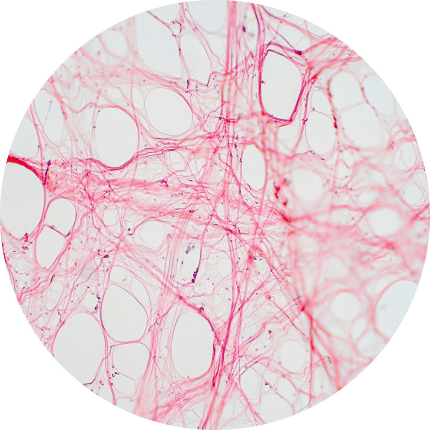 Das «Spinnennetz» der Faszien unter dem Mikroskop. | © Shutterstock