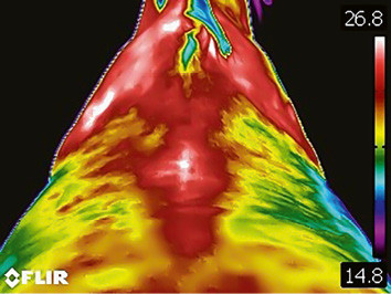 Image 1: Anomalies thermographiques entre autres dans la région des épaules, plus prononcée à gauche qu’à droite